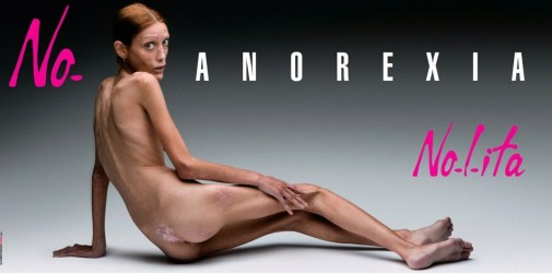 Nolita anorexiamodel